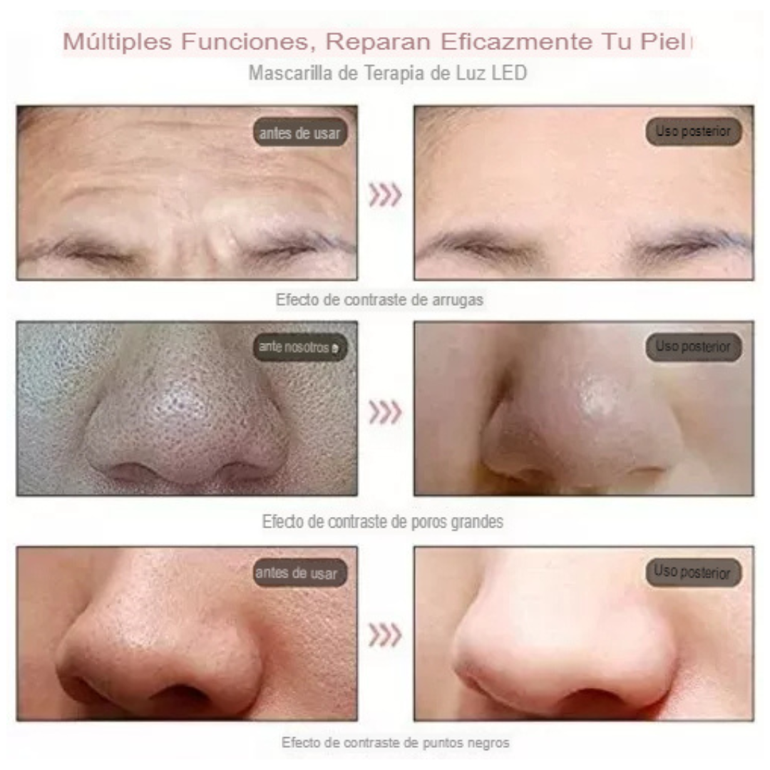Máscara LED 7 Colores — El tratamiento facial que evita ir a la clínica estética 💡
